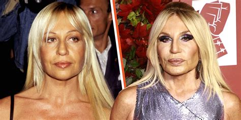 what did donatella versace look like|donatella versace before surgery.